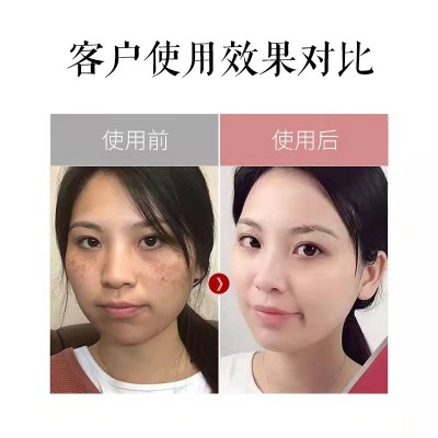 祛斑霜正品美容院577淡化色斑熊果苷去斑半成品美白祛斑霜批发淡图4