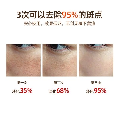 无创溶斑液微晶导入无痛祛斑液零结痂黄褐斑痘印金水原液化妆品图3