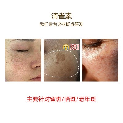 清雀素祛斑液免提取美白无尴尬雀斑老年斑提取液点斑水小样化妆品图2