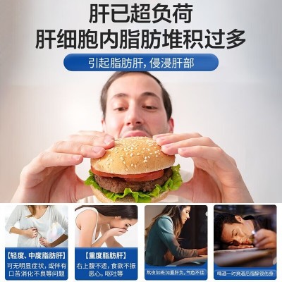 北京同仁堂 赛维牌水飞蓟磷脂片 口苦臭熬夜喝酒养护肝调 节血脂图4