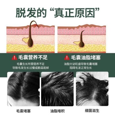 防脱洗发水无硅油去屑固发止痒人参何首乌蓬松控油洗发露批 发代发图2