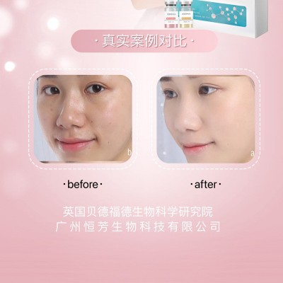 美容院线专供护肤品水光针产品动能素精华液紧致抗皱玻尿酸VC 原液图3
