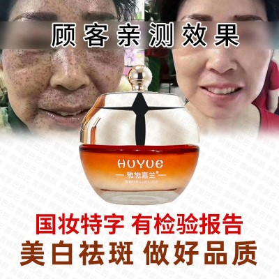 美白淡斑霜雅施嘉兰美白祛斑霜正品黄褐斑雀斑淡斑电商直播批发图3