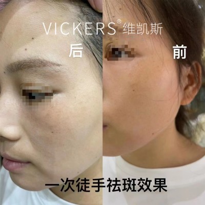 徒手祛斑组合三件套美容院项目色素提取液祛黄提亮修护控色净肤源图4