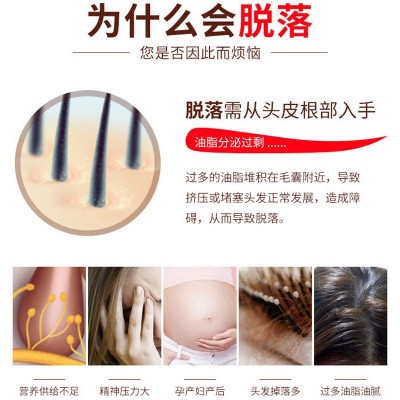 洗发水试用装袋包装酒店旅游便携包装CHUMEN辣木根去屑养发洗发液图3