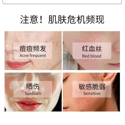 贻贝粘蛋白修护喷雾 修护瘙痒红血丝激素脸滋润控油舒缓 面部精华图4