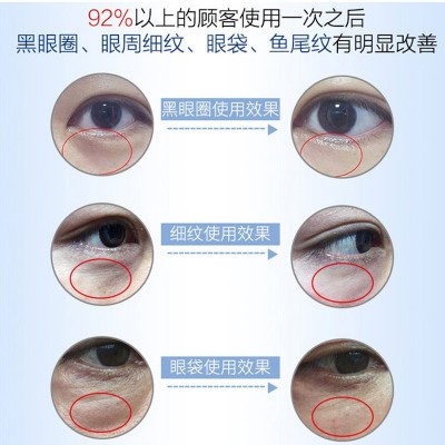 玻尿酸微晶眼贴 去眼袋眼纹鱼尾纹黑眼圈紧致可溶性微针眼贴 批发图2