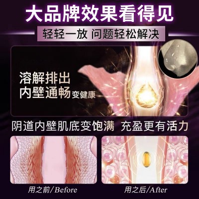 妇炎洁女性抑菌液私密护理套盒阴道清洁抑菌凝胶外用0.6mlx15瓶图4
