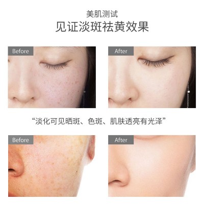 国药集团美容院烟酰胺原液玻尿酸肌肤紧致补水保湿美白淡斑精华液图2