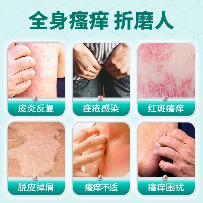 南京同仁堂皮肤喷剂肛周瘙痒湿疹根牛皮股癣皮炎疱疹干燥止痒药膏图2