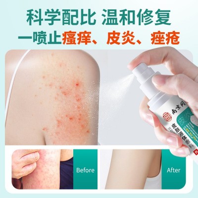 南京同仁堂皮肤喷剂肛周瘙痒湿疹根牛皮股癣皮炎疱疹干燥止痒药膏图4
